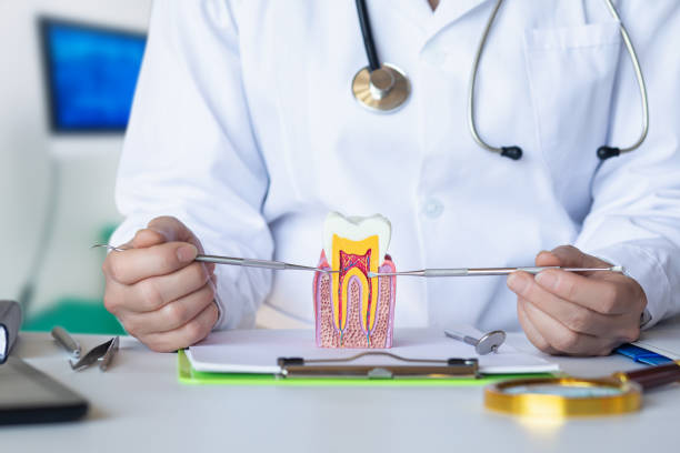 Best Knocked-Out Tooth (Avulsed Tooth) Treatment in Irvine, CA