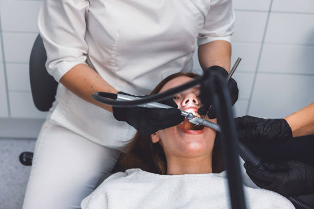 Best Emergency Wisdom Tooth Extraction in Irvine, CA